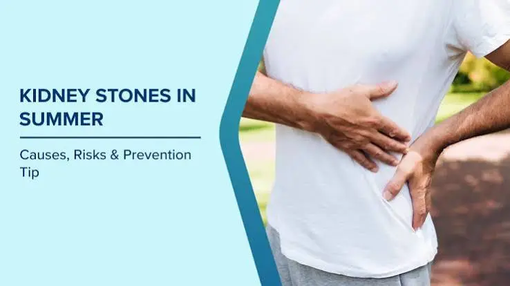 Kidney Stone Prevention Tips